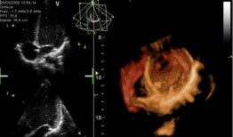 心脏跳动视频,揭秘心脏跳动的奥秘